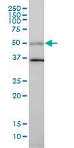 TGFB1I1 Monoclonal Antibody (4B2-D8)