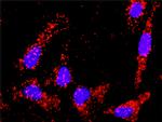 TGFB2 Antibody in Proximity Ligation Assay (PLA) (PLA)