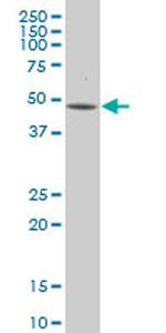 LEFTY2 Monoclonal Antibody (1H6)