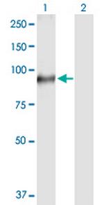 TGM1 Polyclonal Antibody, MaxPab™