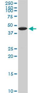 KLF10 Antibody in Western Blot (WB)