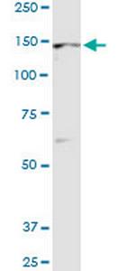TIE1 Antibody in Western Blot (WB)