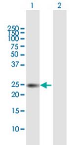 TIMP1 Antibody in Western Blot (WB)