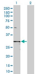 TIMP1 Antibody in Western Blot (WB)
