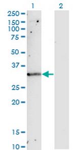 TIMP1 Monoclonal Antibody (4D12)