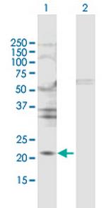 TIMP2 Antibody in Western Blot (WB)