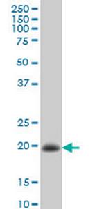 TIMP2 Antibody in Western Blot (WB)