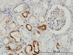 TIMP2 Antibody in Immunohistochemistry (Paraffin) (IHC (P))