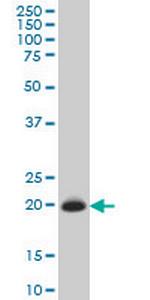 TIMP2 Monoclonal Antibody (5B11)