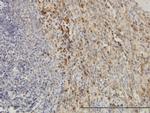 TIMP2 Antibody in Immunohistochemistry (Paraffin) (IHC (P))