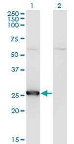 TK1 Monoclonal Antibody (1D10)