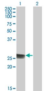 TK1 Monoclonal Antibody (3F9)