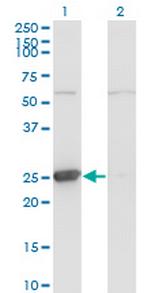 TK1 Monoclonal Antibody (3E2)