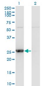 TK1 Monoclonal Antibody (3G10)