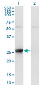 TK1 Monoclonal Antibody (2A2)