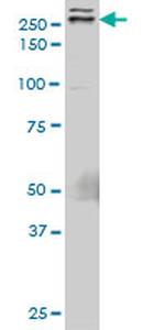 TLN1 Antibody in Western Blot (WB)