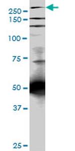 TLN1 Antibody in Western Blot (WB)
