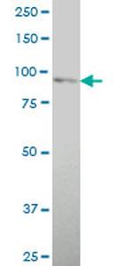 TLR2 Antibody in Western Blot (WB)