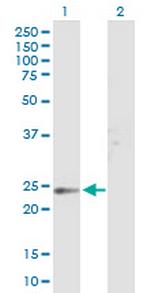 TSPAN8 Antibody in Western Blot (WB)