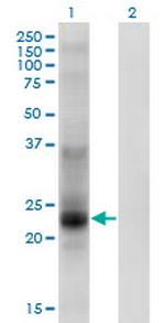 TSPAN8 Monoclonal Antibody (1E5)