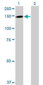TMEM1 Polyclonal Antibody, MaxPab™