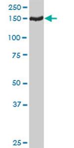 TMEM1 Antibody in Western Blot (WB)