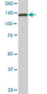 TMEM1 Monoclonal Antibody (5D5)