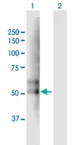 TMPRSS2 Polyclonal Antibody, MaxPab™