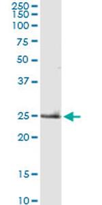 TNF Antibody in Western Blot (WB)