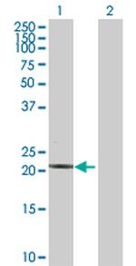 TNNI2 Polyclonal Antibody, MaxPab™