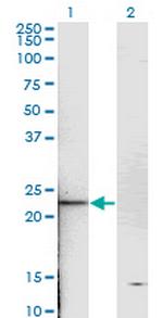 TNNI2 Monoclonal Antibody (2D5)