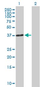 TNNT1 Polyclonal Antibody, MaxPab™