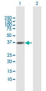 TNNT1 Polyclonal Antibody, MaxPab™