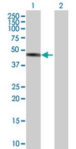 TNNT2 Polyclonal Antibody, MaxPab™
