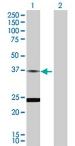 TNNT2 Polyclonal Antibody, MaxPab™