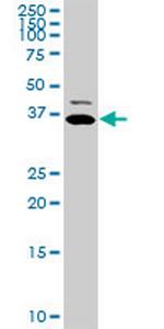 TNNT2 Monoclonal Antibody (3H4-F7)