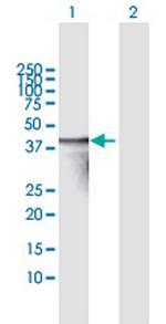 TNNT3 Polyclonal Antibody, MaxPab™