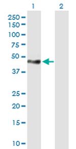 TNS1 Polyclonal Antibody, MaxPab™