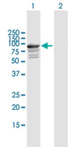 TNXB Antibody in Western Blot (WB)