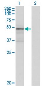 TNXB Antibody in Western Blot (WB)