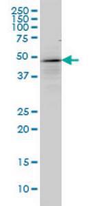 TP53 Antibody in Western Blot (WB)