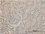 TP53 Antibody in Immunohistochemistry (Paraffin) (IHC (P))