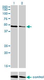 TP53 Antibody in Western Blot (WB)