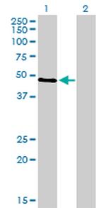 TP53 Antibody in Western Blot (WB)