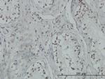 TP53BP2 Monoclonal Antibody (3F8)