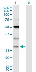 TPD52 Polyclonal Antibody, MaxPab™