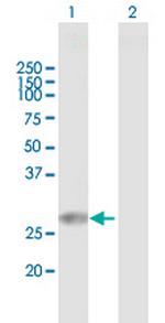 TPD52L2 Polyclonal Antibody, MaxPab™