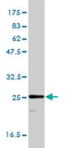 TPI1 Monoclonal Antibody (1D10-2E2)