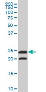TPI1 Antibody in Western Blot (WB)