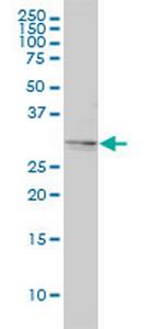 TPM4 Monoclonal Antibody (4E4-1D2)